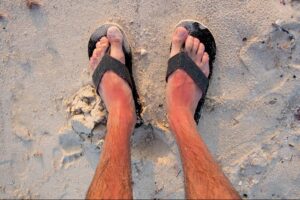 man-sues-south-florida-beach-resort-after-claiming-his-foot-was-left-‘seriously-impaired’-due-to-‘searing’-pool-deck