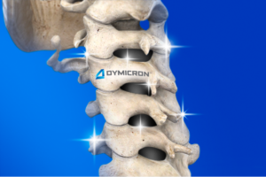 this-startup-is-aiming-to-solve-the-biggest-problem-in-the-fast-growing-spinal-disc-market